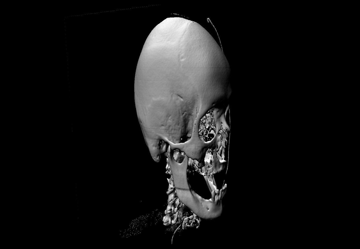 A-3D-Volume-Rendering-Example-of-a-Skull