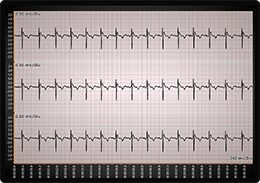 WPF ECG EKG chart millimeter grid example