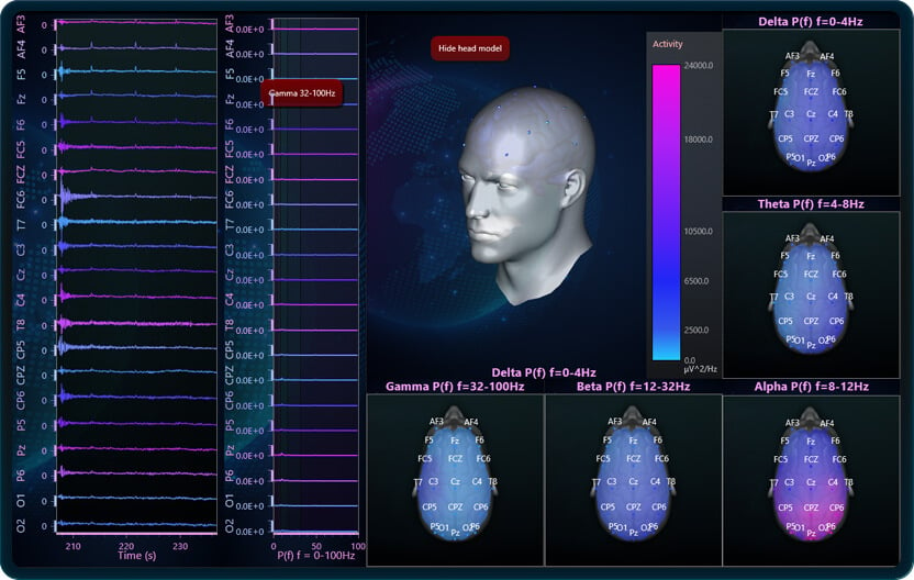 EEG visualization showcase